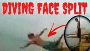 split face diving accident
